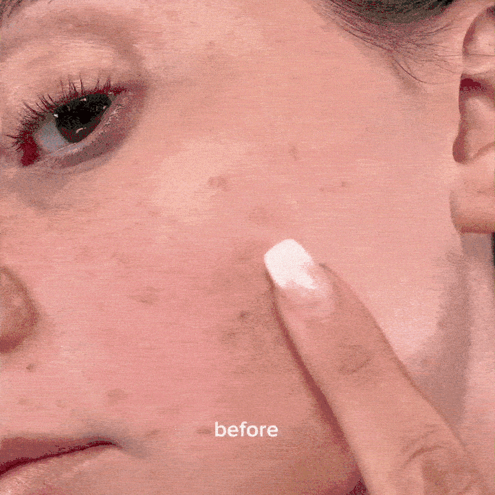 Dr.Althea - 345 Relief Cream