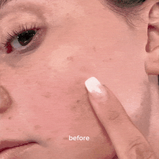 Dr.Althea - 345 Relief Cream